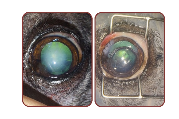 Cirurgia de Catarata